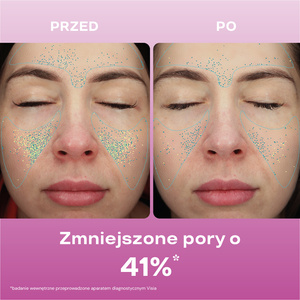 Zestaw: Napięcie i gładkość